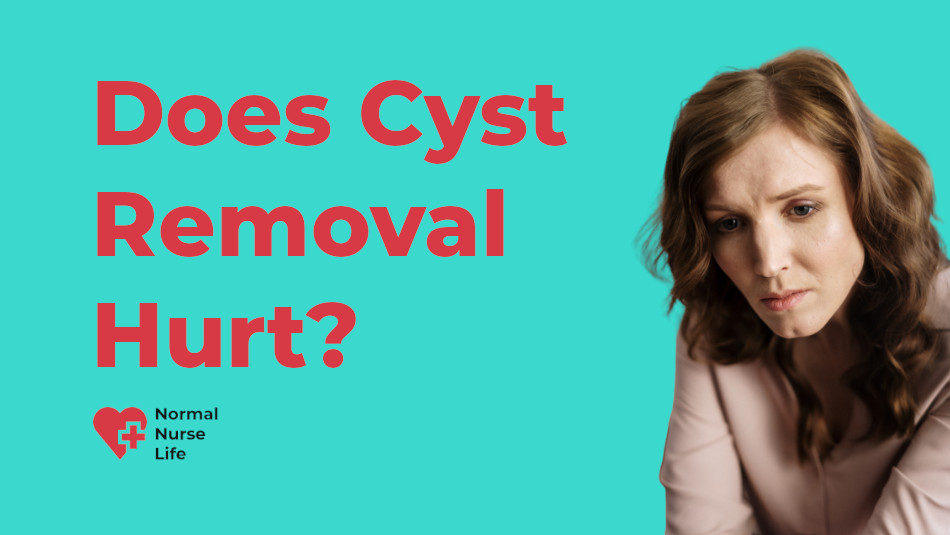 Does cyst removal hurt