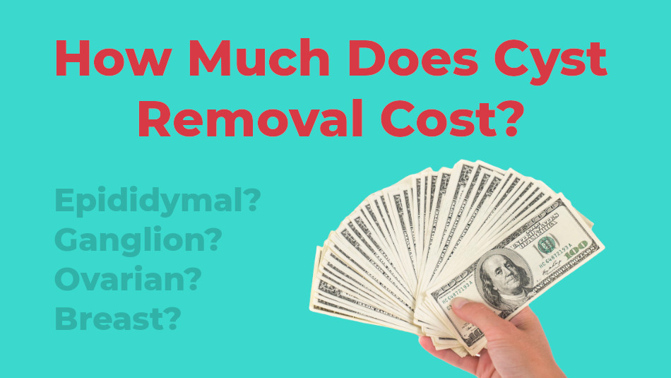 How much does cyst removal cost