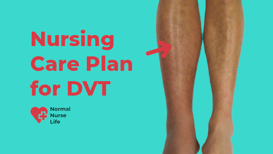 Nursing care plan for DVT