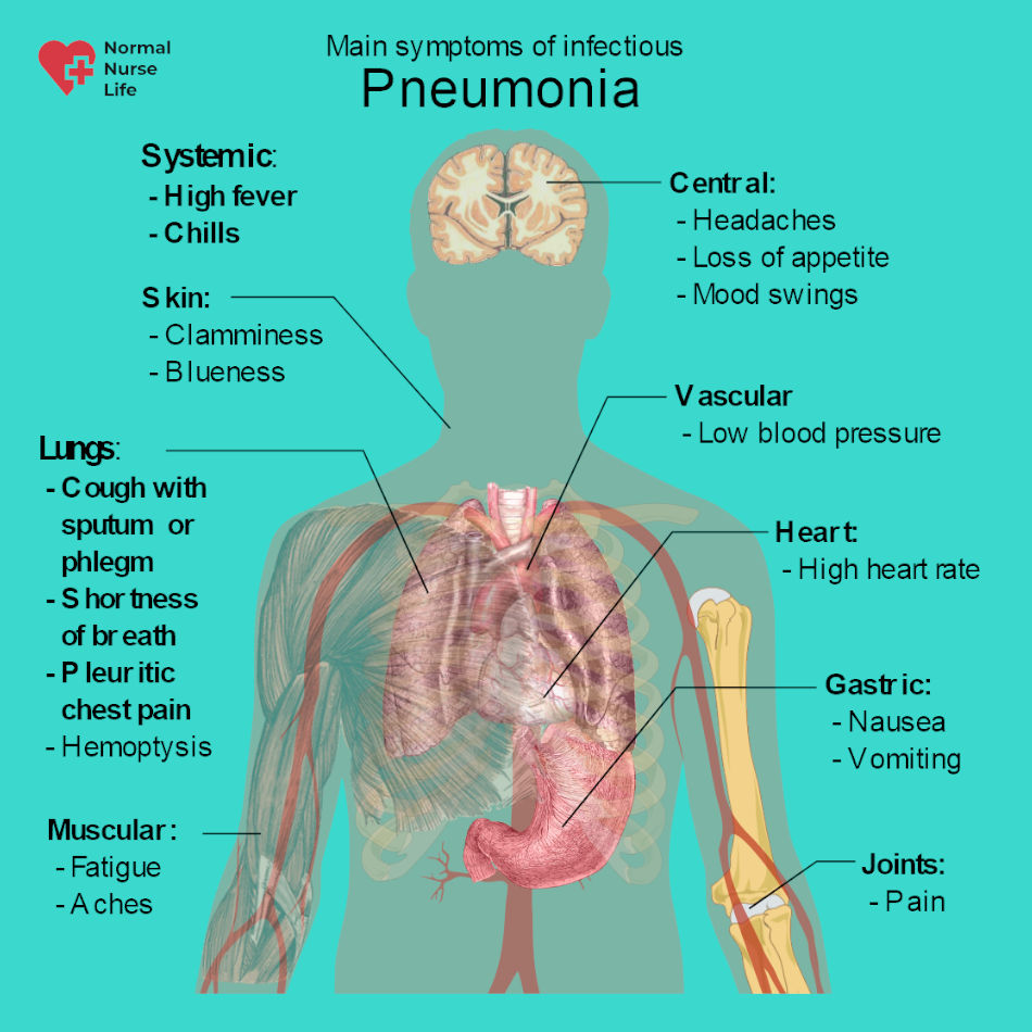 Symptoms of pneumonia